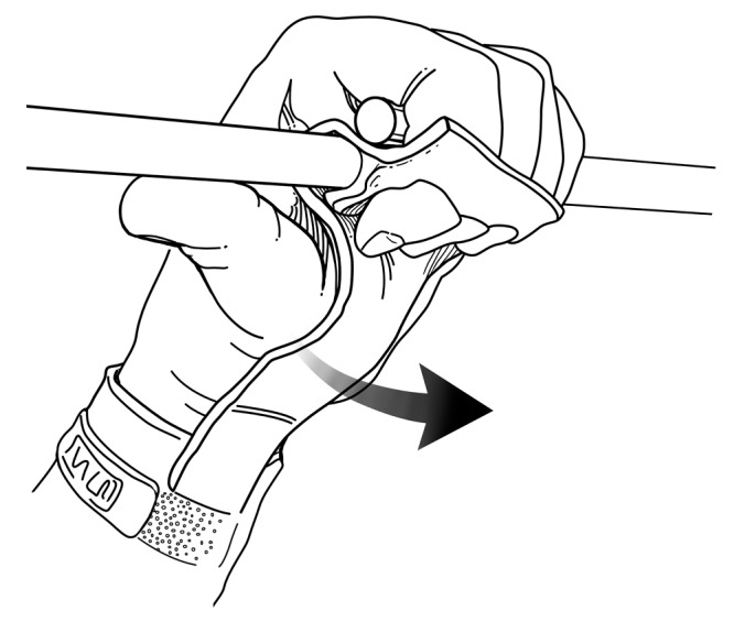 Gymnastics Injury Prevention